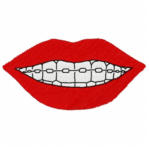 Braces Smile Embroidery Design AnnTheGran
